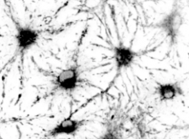 新工具让研究人员更好地了解大脑干细胞衰老